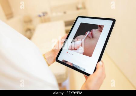 professionnel de la santé tient une tablette affichant une photo en gros plan d'une procédure d'injection de lèvres sur les médias sociaux, présentant un résultat de traitement cosmétique i. Banque D'Images