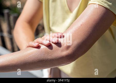 Femme appliquant de la crème solaire sur le bras pour protéger la peau Banque D'Images
