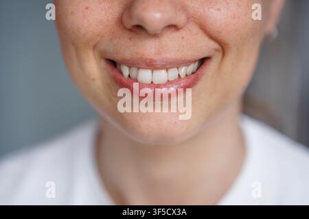 Gros plan détaillé du bas du visage d'une jeune femme arborant un sourire doux et authentique, une peau claire avec des taches de rousseur naturelles sur le nez et les joues, beauté de soins de la peau, émotion authentique, style de vie joyeux de la jeunesse Banque D'Images