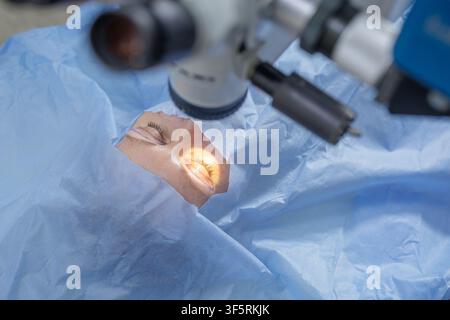 Une vue rapprochée d'une procédure de blépharoplastie moderne, mettant en évidence le microscope chirurgical et les paupières du patient marquées pour correction, soulignant Banque D'Images
