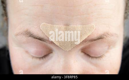 Close-up du visage d'une femme de 40 ans non identifiable portant un patch en tissu de forme triangulaire entre les sourcils pour réduire les rides du front. Banque D'Images