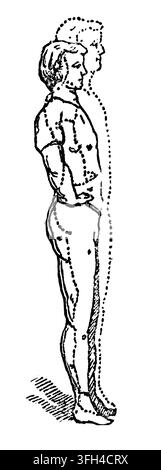 Illustration antique montrant un mouvement spécifique d'éducation physique ou un exercice de calisthenics pour hommes (dix-septième exercice). Gravure sur bois authentique d'un Banque D'Images