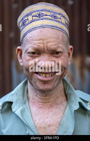 Portrait rapproché d'un homme albinos souriant portant une casquette kofia brodée jaune et violette et une chemise vert pâle ouverte devant un mur métallique rouillé Banque D'Images