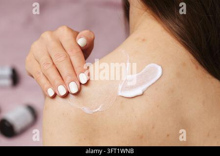 Femme appliquant une crème de soins blanche sur l'épaule avec une irritation cutanée visible. Arrière-plan dermatologique pour les soins du corps, le traitement de la peau et l'hydratation. Banque D'Images