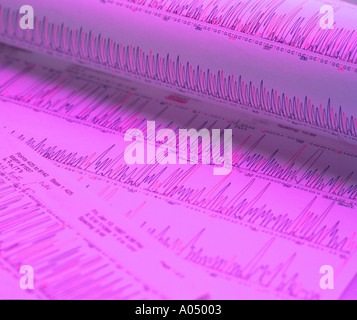 Imprimé d'ordinateur de l'ADN Banque D'Images
