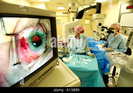 Opération de la cataracte vu en gros plan sur l'écran d'opération avec femme médecin et l'infirmière derrière. Banque D'Images