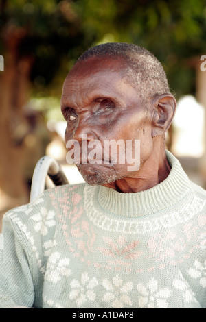 Blind leper en fauteuil roulant à l'Liteta non valide lépreux composé dans Lusaka Zambie Banque D'Images