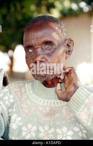 Les aveugles et les enfants lépreux en fauteuil roulant à l'Liteta non valide lépreux composé dans Lusaka Zambie Banque D'Images