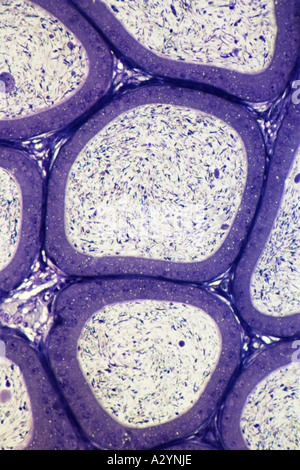 Des spermatozoïdes dans l'épididyme tubules Banque D'Images