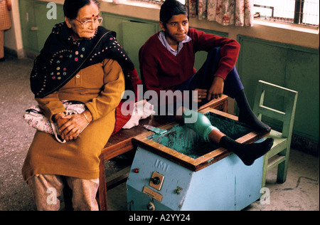 Boy having molten hot wax de traitement après la chirurgie pour réparer sa jambe après avoir contracté la polio, Amar jyoti hôpital , New delhi Banque D'Images