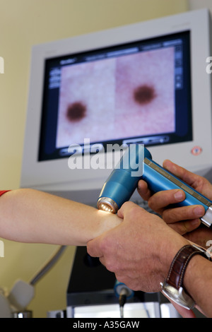 Le spécialiste de la peau MD Serko von Düben examine un patient avec un dermatoscope vidéo Banque D'Images