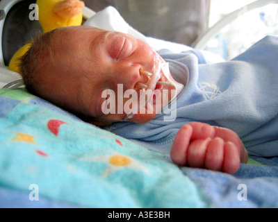 Garcon Bebe Premature Ne A 28 Semaines De Gestation Dans Un Incubateur Portant Une Canule Nasale Photo Stock Alamy