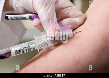 Échantillon de sang prises à partir de veines de bras pour un test sanguin. Cette image est vraie, pas avec des modèles. C'est un vrai test de sang ! Banque D'Images
