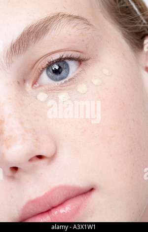 Une jeune femme l'application de crème glacée sous son œil close up Banque D'Images