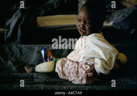 La guerre civile rwandaise - un an, fille, la seule survivante de sa famille qui ont tous été assassinés par des bandes de Hutus, dans l'hôpital de la Croix rouge internationale avril 1994 Banque D'Images