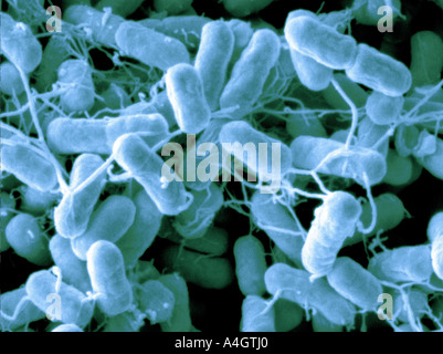 Il s'agit d'une amélioration de l'analyse des électrons Microphotographie couleur de l'aliment né pathogène Salmonella typhimurium Banque D'Images