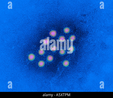 Microscope électronique en transmission de l'image négative des vitraux hepa Banque D'Images