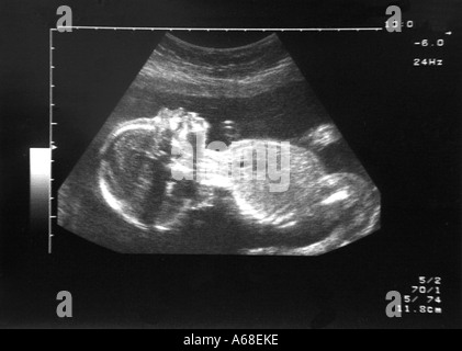 Vingt semaines échographie d'un fœtus en santé Banque D'Images
