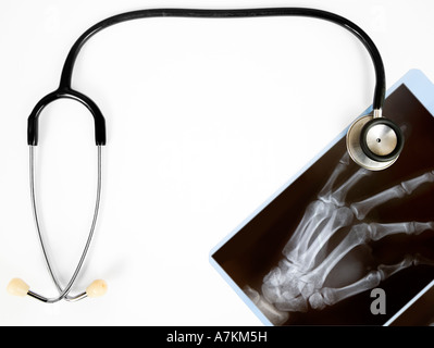 Une radiographie d'une main avec un stéthoscope isolated on white Banque D'Images
