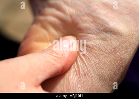 Massage pour le talon du pied dans le cadre d'un massage corporel thaïlandais Banque D'Images