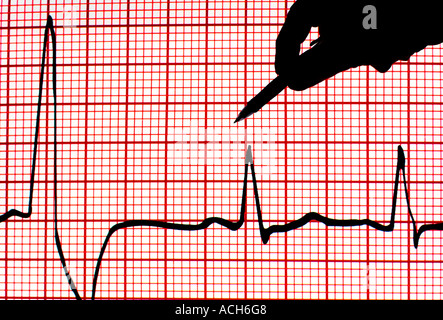 Vue conceptuelle d'une main avec un pointeur projetée sur un grand écran d'un électrocardiogramme électrocardiogramme au cours d'un séminaire de recherche Banque D'Images