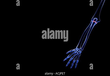 Les os du membre supérieur Banque D'Images