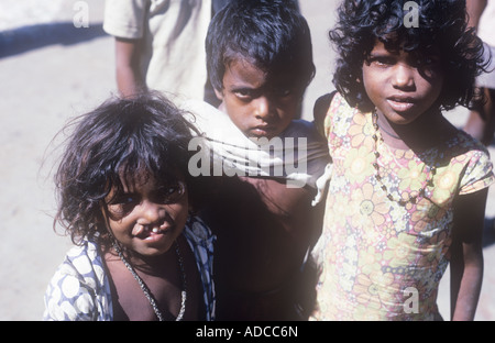 Fille aux lèvres, cheveux ou du palais, et d'autres enfants des rues de Mumbai Inde Banque D'Images