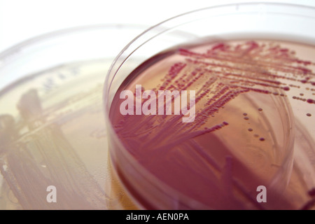 Les colonies de bactéries qui croissent sur des boîtes de Petri Banque D'Images