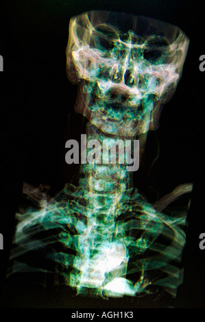 MRI-image en 3D d'un humain (imagerie par résonance magnétique) Banque D'Images