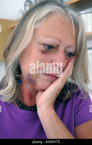 Femme a fortement entamé et battus. Banque D'Images