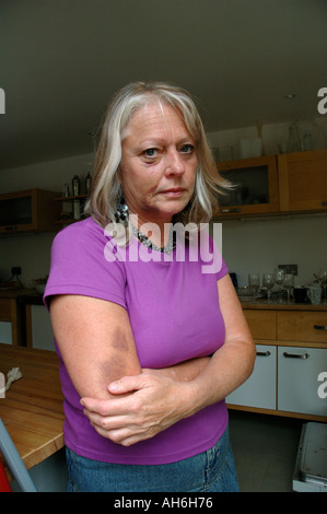 Femme a fortement entamé et battus. Banque D'Images