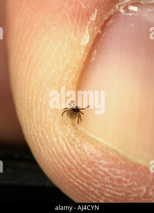 Ricin européenne européenne tique Ixodes ricinus tique des moutons sur un doigt Banque D'Images