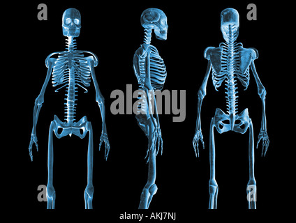 Différentes vues des squelettes squelette Skelette verschiedene Ansichten Banque D'Images