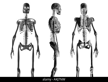 Différentes vues des squelettes squelette Skelette verschiedene Ansichten Banque D'Images