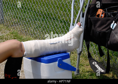 Softball féminin les entorses de cheville blessures sportives en raison de jouer au baseball Banque D'Images