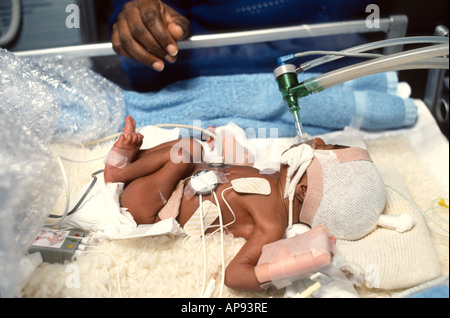 Bébé prématuré dans l'unité néonatale Banque D'Images