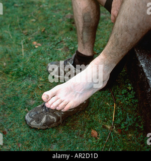 La plaie, la fatigue et la douleur de l'homme ont meurtri le pied avec un gonflement après avoir disputé la course de Man v Horse à Llanwrtyd Wells Powys Wales UK KATHY DEWITT Banque D'Images