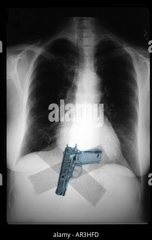 La sécurité de l'aéroport simulé xray montrant un Smith et Wesson 9mm pistolet collé sur une personne de sa taille Banque D'Images