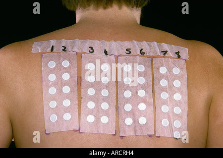 Une photographie de tests de correctifs pour les allergies Banque D'Images