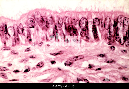 Une Photomicrographie montrant un épithélium cilié de l'utérus. Banque D'Images