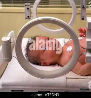 Bébé prématuré en couveuse Banque D'Images