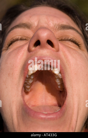 Femme avec les dents avant de crier manquant Banque D'Images