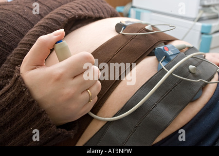 Un patient a reçu un test à la TRF nonstress CHUL à Québec. NST est un temps d'enregistrement de la série doppler du coeur Banque D'Images