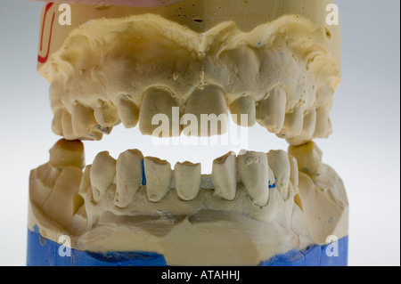 Modell für Zahnersatz, prothèses dentaires Banque D'Images