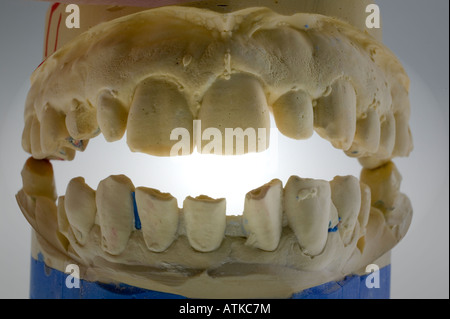 Modell für Zahnersatz prothèses dentaires Banque D'Images