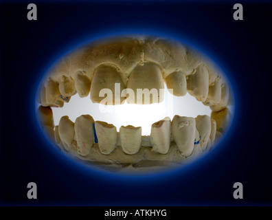 Modell für Zahnersatz prothèses dentaires Banque D'Images