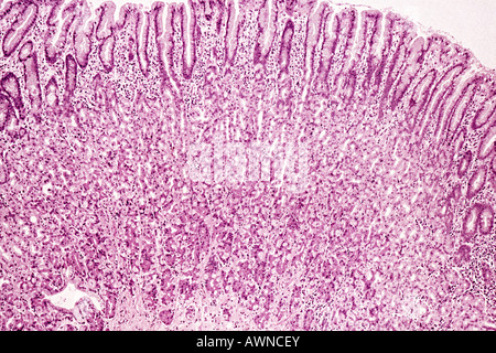 Muqueuse de l’estomac Banque D'Images