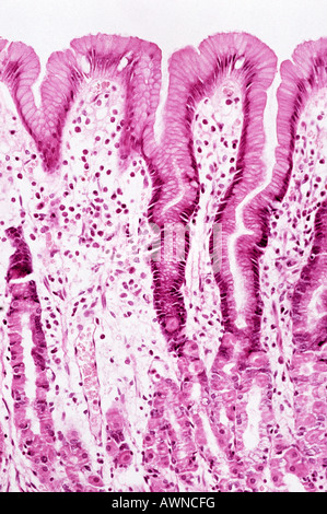 Muqueuse de l’estomac Banque D'Images