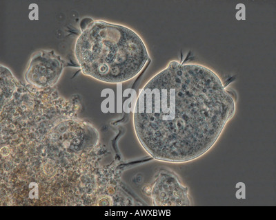 (Vorticella Vorticella spec.), avec l'IRM en contraste de phase Banque D'Images