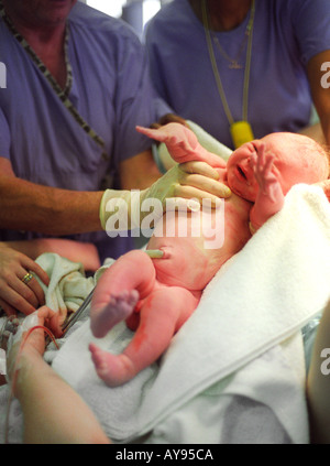 Bébé nouveau-né est remis à la mère juste après la naissance avec cordon encore attaché. Banque D'Images